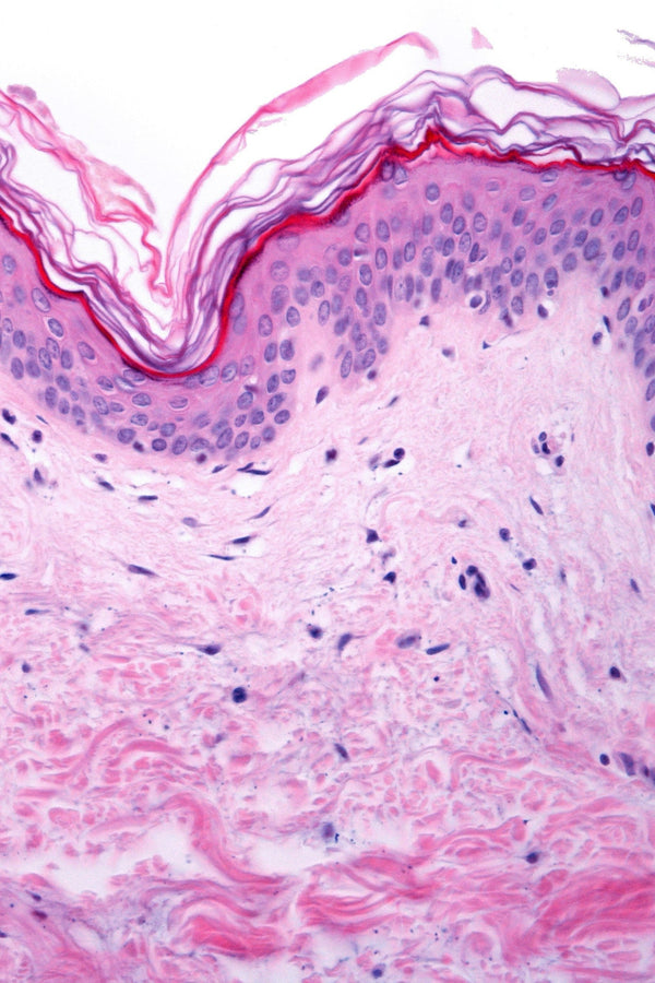 Senolytic Trial in Skin, With Broader Implications